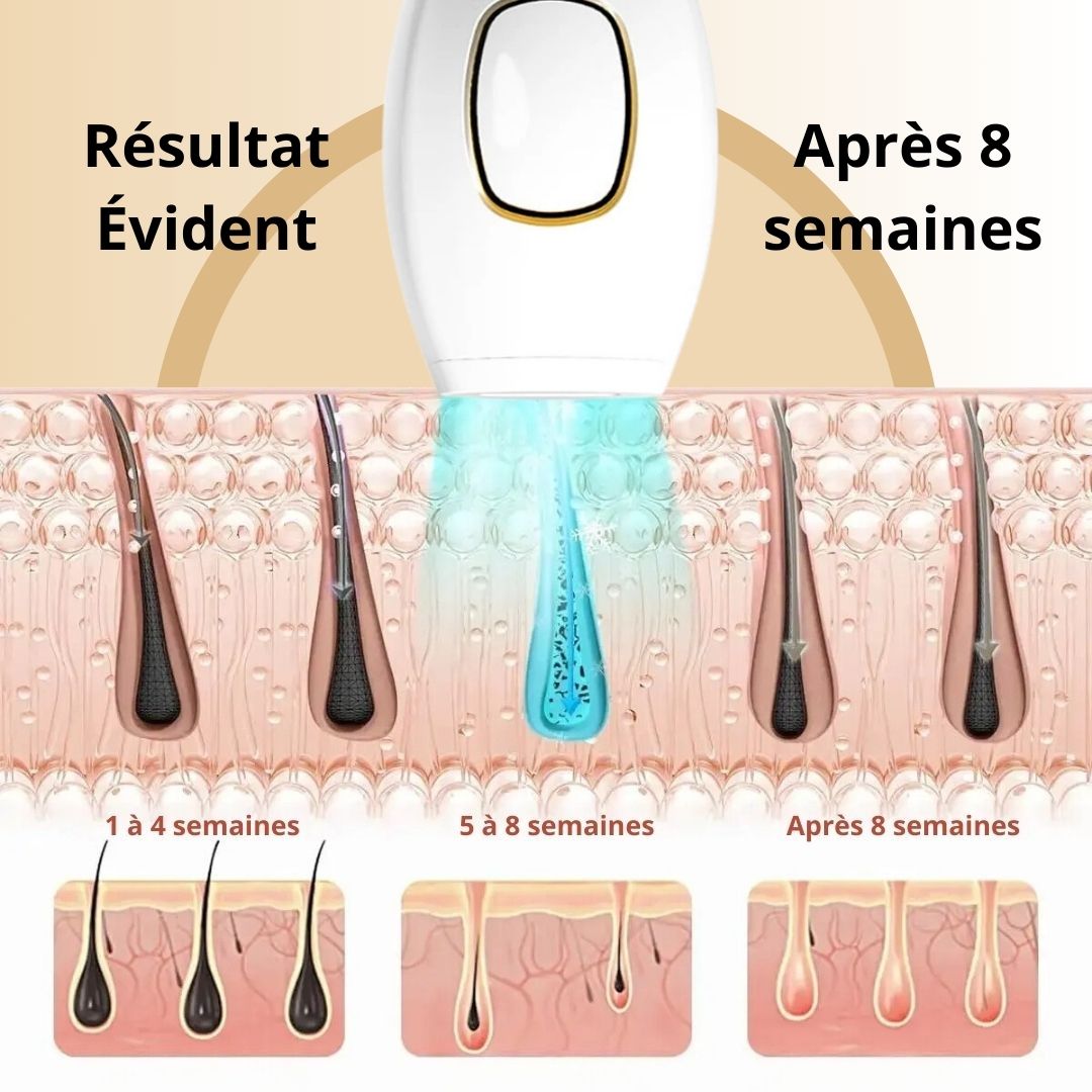 EPILATEUR-A-LUMIERE-PULSEE-RESULTAT